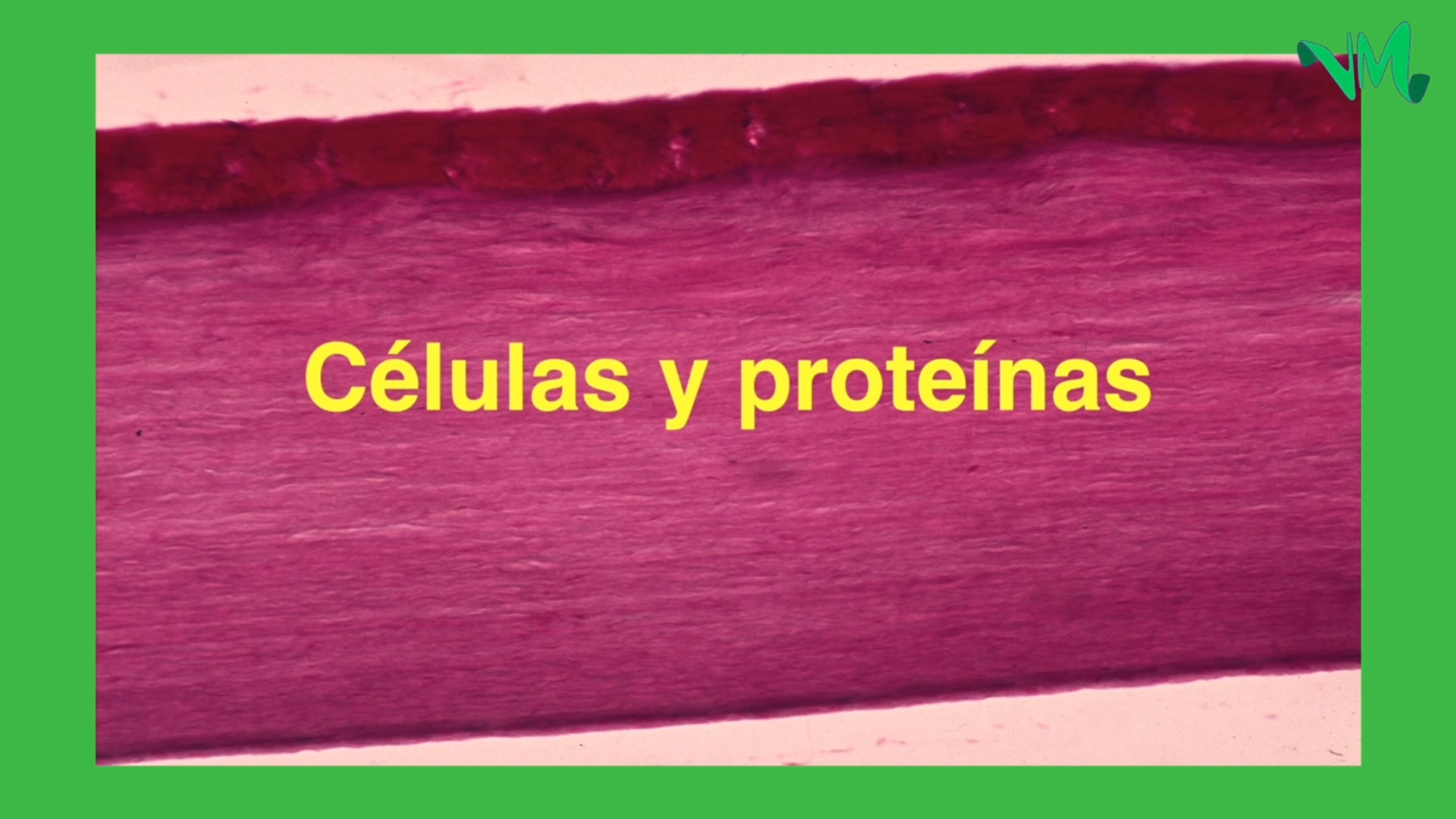 VER MEJOR: CATARATAS Y ENFERMEDAD ENDOTELIAL