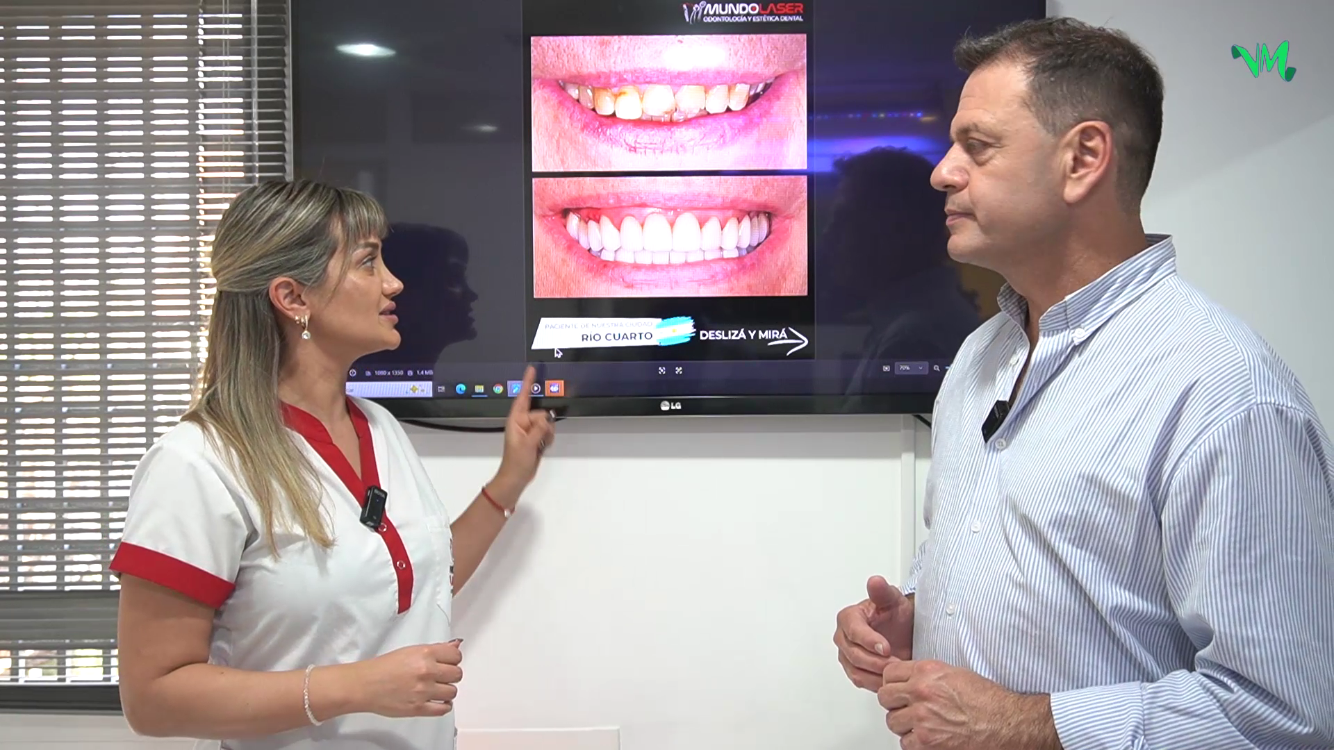 IMPLANTOLOGÍA: DISEÑO DE UNA SONRISA